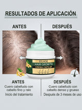 Crema Capilar Hair Growth para Cuero Cabelludo | Envío Gratis Colombia